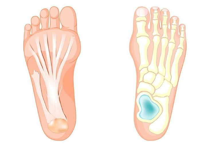 کف پا و نقش آن در حفظ تعادل بدن